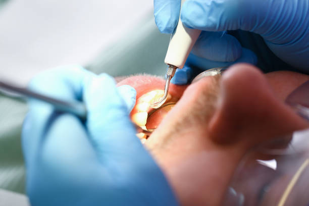 Best Emergency Treatment for Jaw Pain or Injury in Yoe, PA
