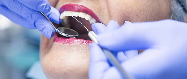 Best Emergency Wisdom Tooth Extraction in Yoe, PA